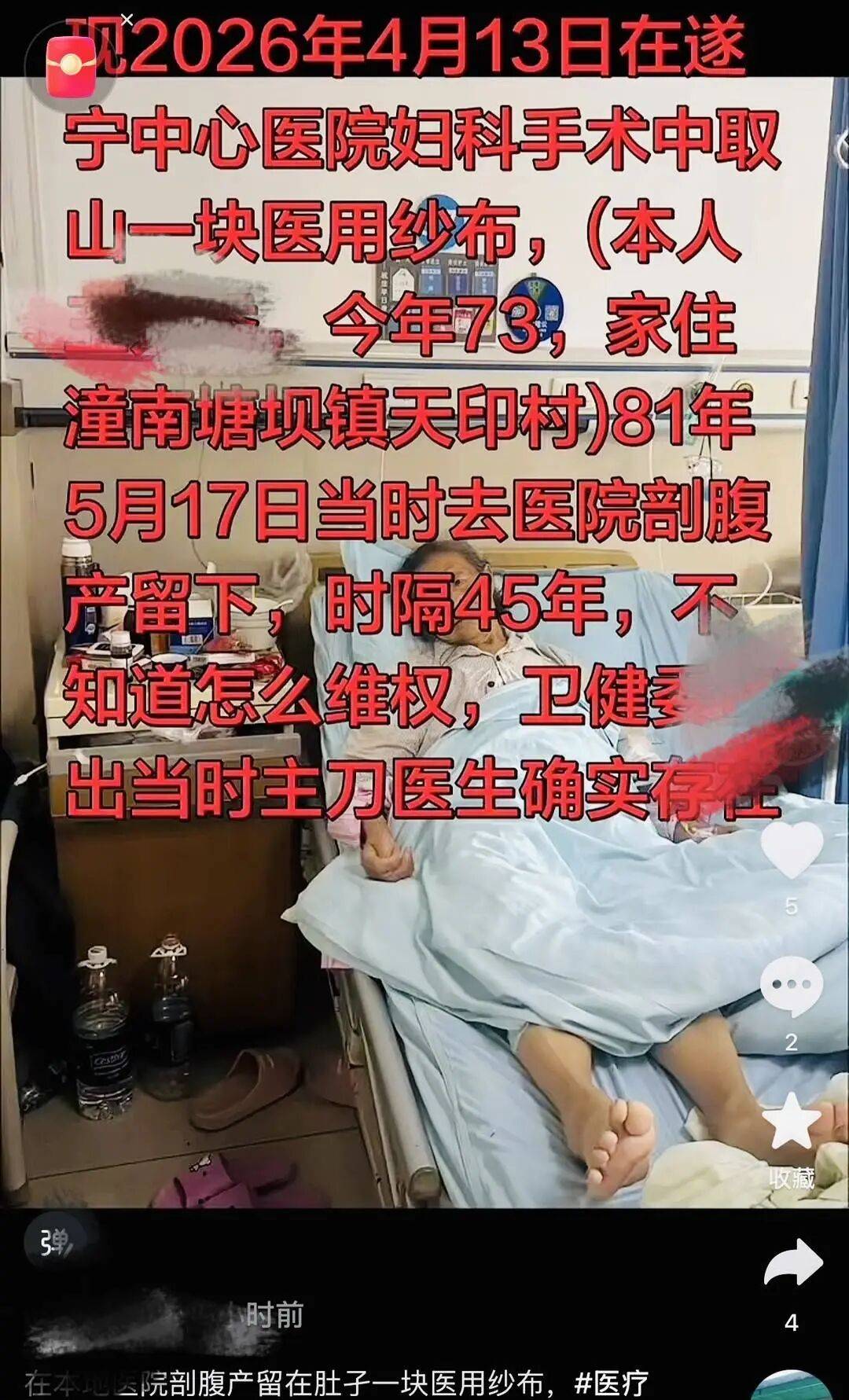 重庆73岁患者体内发现45年前遗留纱布,涉事卫生院:已启动调查,时间久远调查难度大,当年工作的医生一人已离世,另一人长期未回重庆